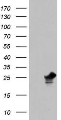 Western Blot: PAFAH1B3 Antibody (OTI5D2) [NBP2-46314]