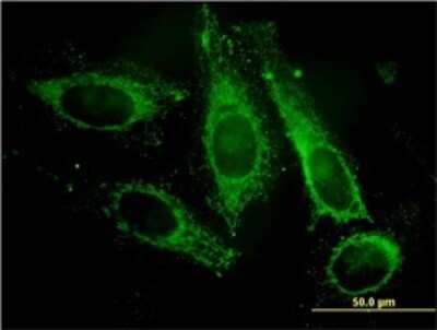 Immunocytochemistry/ Immunofluorescence: PAFAH1B3 Antibody (8C11) [H00005050-M02]
