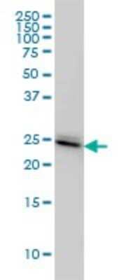 Western Blot: PAFAH1B3 Antibody (8C11) [H00005050-M02]