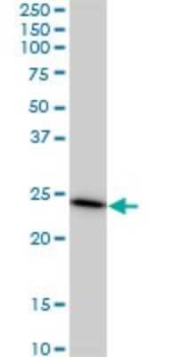 Western Blot: PAFAH1B3 Antibody (8C11) [H00005050-M02]