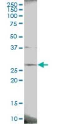 Western Blot: PAFAH1B3 Antibody [H00005050-B01P]