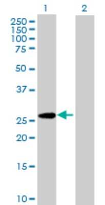 Western Blot: PAFAH1B3 Antibody [H00005050-B01P]