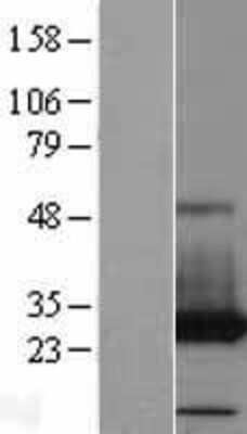 Western Blot: PAFAH1B3 Overexpression Lysate [NBP2-09769]