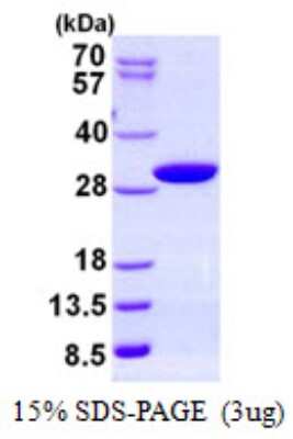 SDS-PAGE: Recombinant Human PAFAH1B3 His Protein [NBP2-23337]