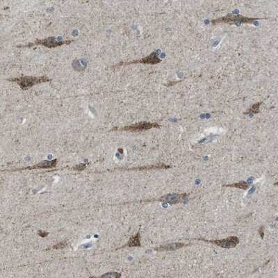 Immunohistochemistry-Paraffin: PAFAH2 Antibody [NBP1-81687]