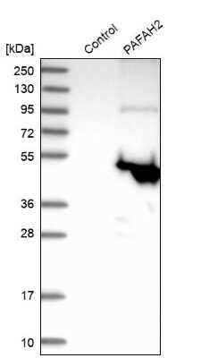 Western Blot: PAFAH2 Antibody [NBP1-81687]