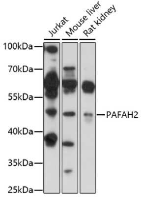 Western Blot: PAFAH2 AntibodyAzide and BSA Free [NBP2-94832]