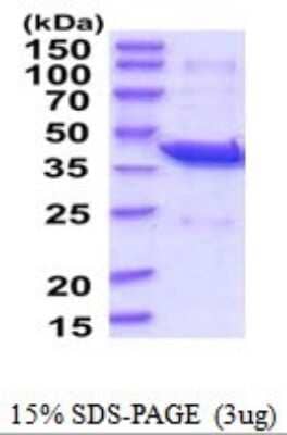 SDS-PAGE: Recombinant Human PAFAH2 His Protein [NBP2-52046]