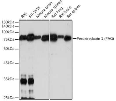 Western Blot: PAG1 Antibody (0K5F4) [NBP3-15731]