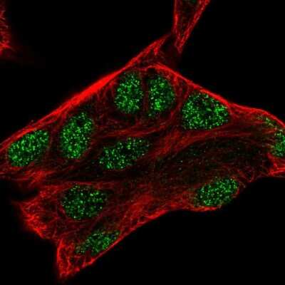 Immunocytochemistry/ Immunofluorescence: PAG608 Antibody [NBP2-55349]