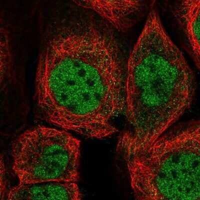 Immunocytochemistry/ Immunofluorescence: PAG608 Antibody [NBP2-58074]