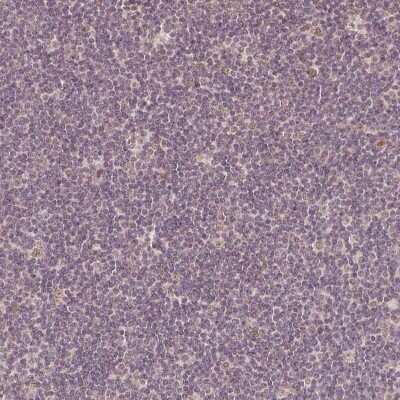 Immunohistochemistry-Paraffin: PAG608 Antibody [NBP2-62599]