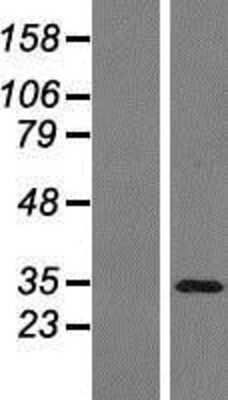 Western Blot: PAG608 Overexpression Lysate [NBP2-06431]