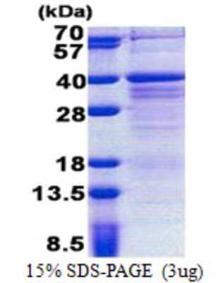 SDS-PAGE: Recombinant Human PAG608 His Protein [NBP2-22962]