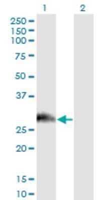 Western Blot: PAGE1 Antibody (6G6) [H00008712-M01]