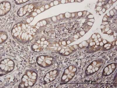 Immunohistochemistry-Paraffin: PAGE1 Antibody [H00008712-B01P]