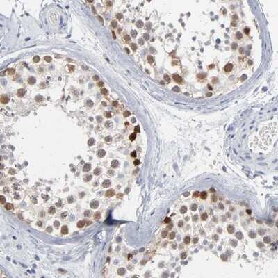 Immunohistochemistry-Paraffin: PAGE1 Antibody [NBP1-85414]
