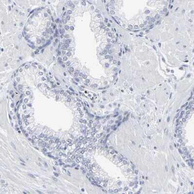 Immunohistochemistry-Paraffin: PAGE1 Antibody [NBP1-85414]