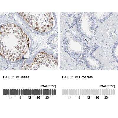Immunohistochemistry-Paraffin: PAGE1 Antibody [NBP1-85414]