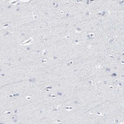 Immunohistochemistry-Paraffin: PAGE1 Antibody [NBP1-85414]