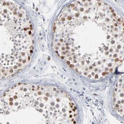 Immunohistochemistry-Paraffin: PAGE1 Antibody [NBP1-85414]