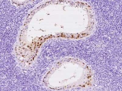 Immunohistochemistry-Paraffin: PAGE1 Antibody [NBP2-97691]