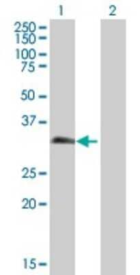 Western Blot: PAGE1 Antibody [H00008712-B01P]