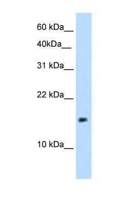 Western Blot: PAGE1 Antibody [NBP1-58313]