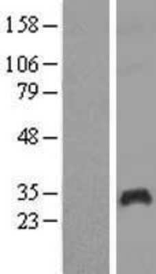 Western Blot: PAGE1 Overexpression Lysate [NBL1-14069]