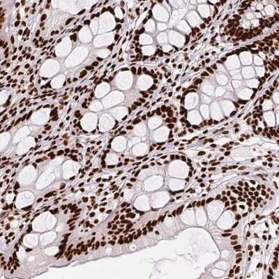 Immunohistochemistry: PAGE3 Antibody [NBP2-49362]