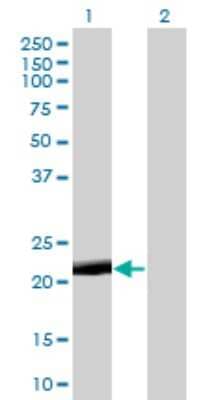 Western Blot: PAGE4 Antibody (7C3) [H00009506-M01]