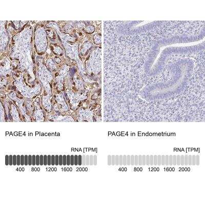 Immunohistochemistry-Paraffin: PAGE4 Antibody [NBP1-85413]