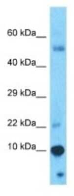 Western Blot: PAGE4 Antibody [NBP3-10548]