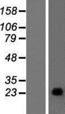 Western Blot: PAGE4 Overexpression Lysate [NBP2-07544]