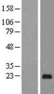 Western Blot: PAGE5 Overexpression Lysate [NBL1-14070]