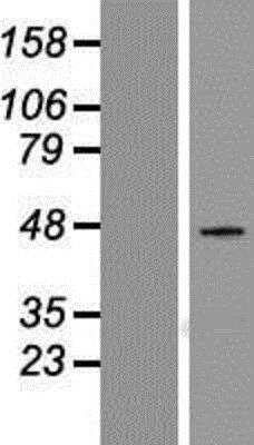 Western Blot: Serpin E1/PAI-1 Overexpression Lysate [NBP2-09008]