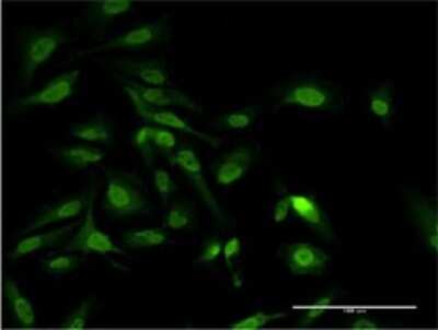 Immunocytochemistry/ Immunofluorescence: PAIP1 Antibody (2D11) [H00010605-M04]