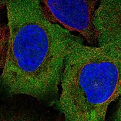 Immunocytochemistry/ Immunofluorescence: PAIP1 Antibody [NBP2-56045]