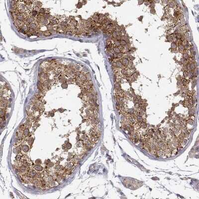 Immunohistochemistry-Paraffin: PAIP1 Antibody [NBP2-68963]