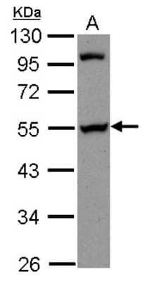 Western Blot: PAIP1 Antibody [NBP2-19679]