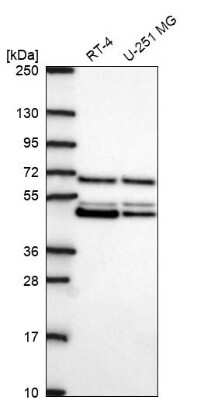 Western Blot: PAIP1 Antibody [NBP2-68963]