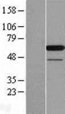 Western Blot: PAIP1 Overexpression Lysate [NBL1-14074]