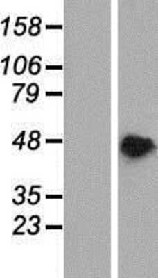 Western Blot: PAIP1 Overexpression Lysate [NBP2-10060]