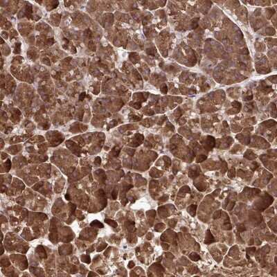 Immunohistochemistry: PAIP2 Antibody [NBP2-38802]