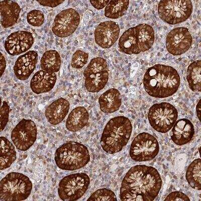 Immunohistochemistry-Paraffin: PAIP2 Antibody [NBP1-80954]