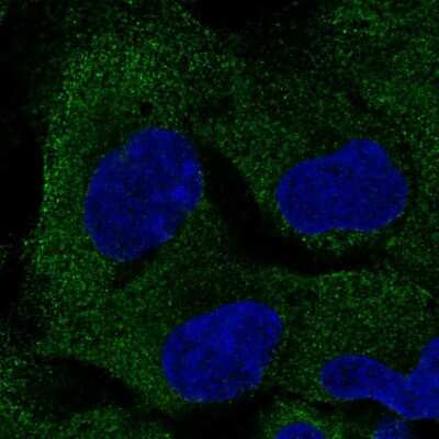 Immunocytochemistry/ Immunofluorescence: PAIP2B Antibody [NBP2-55980]