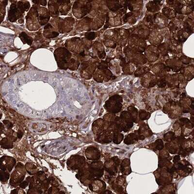 Immunohistochemistry-Paraffin: PAIP2B Antibody [NBP2-30969]