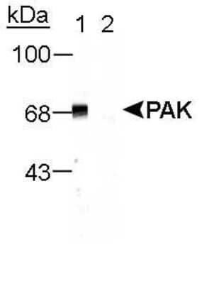 Western Blot: PAK1/2/3 [p Thr402] Antibody [NB100-723]