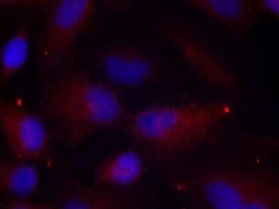 Immunocytochemistry/ Immunofluorescence: PAK1/2/3 [p Thr423, p Thr402, p Thr421] Antibody [NB100-82131]