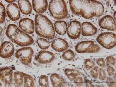 Immunohistochemistry-Paraffin: PAK1 Antibody (4D1) [H00005058-M02]